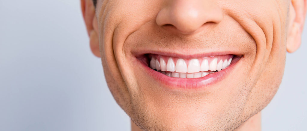 smile close up, Dental Whitening Special